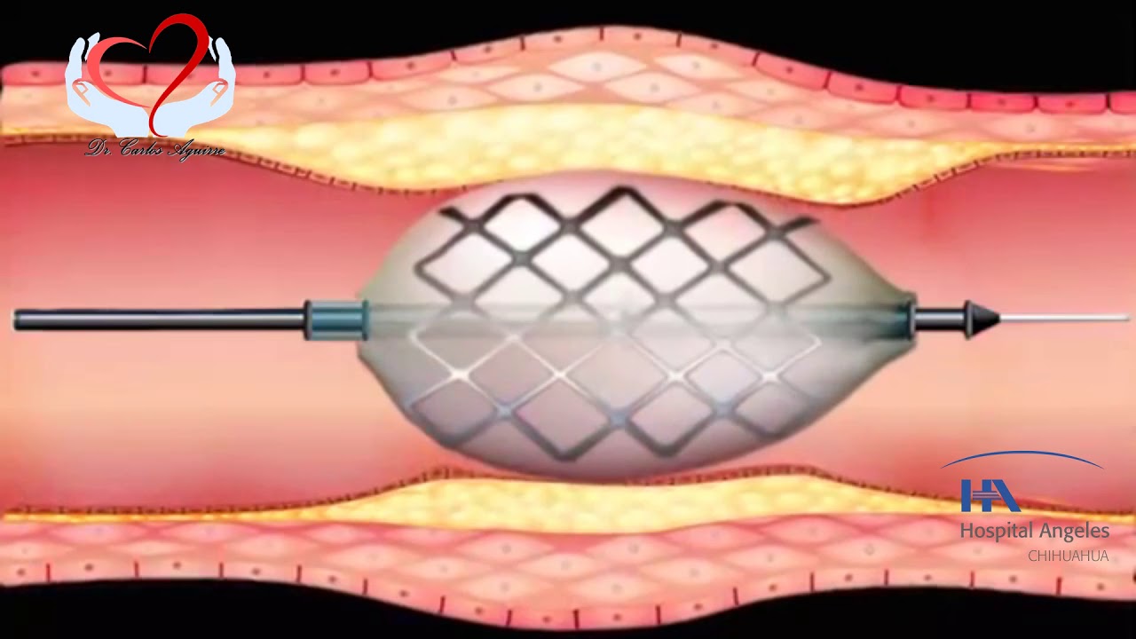 Carlos Alberto Aguirre Molina-19