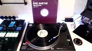 Noel Nanton - Mongo Bongo (Onionz Mix)