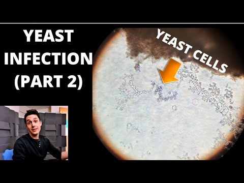 Yeast Infection Under The Microscope (Part 2)