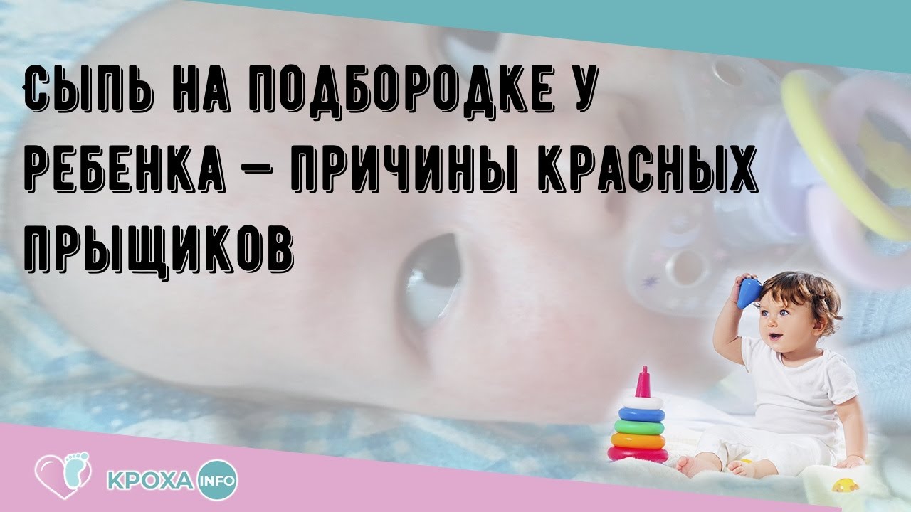 Сыпь на подбородке у ребенка — причины красных прыщиков