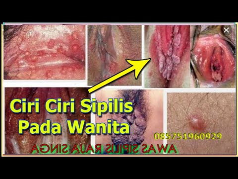 Impotensi dapat disembuhkan Obat-obatan untuk meningkatkan potensi harga laki-laki zidena