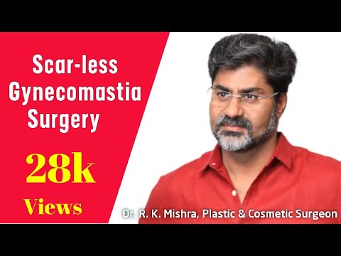 Gynecomastia Surgery in Lucknow | Scar-less Trans-Nipple Incision by Dr. R. K. Mishra
