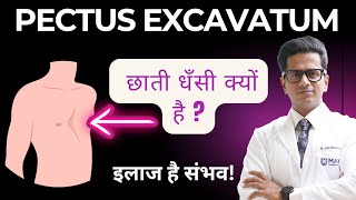 Pectus Excavatum क्या है? छाती धँसने की बीमारी का इलाज | Dr Kamran Ali