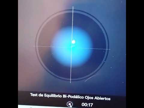 TEST RIESGO DE CAIDA CUANTIFICANDO TRABAJO EN PROTESIS DE RODILLA