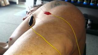 Mind and Muscle - Roger White demonstrates Western Acupuncture