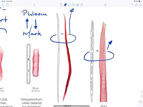 Zelltypen des Xylems