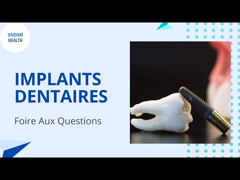IMPLANTS DENTAIRES- Foire Aux Questions