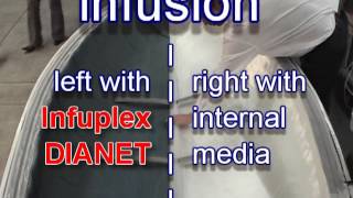 INFUPLEX DIATEX EN