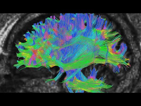 New AI System Can Accurately Diagnose Autism Spectrum ...