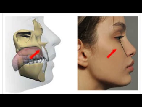 HOW TO MEW CORRECTLY ✅