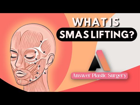 What is SMAS Lifting? | Answer Plastic Surgery