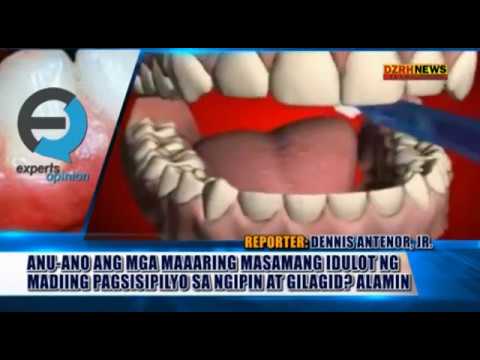 Diyeta sa mawala timbang sa 10 kg para sa 1 buwan Na nawala ang timbang sa perehil