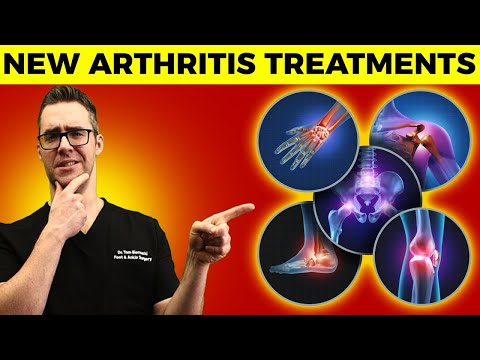 What Causes Bunions What is a bunion How Do You Get Bunions