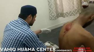 preview picture of video 'Dr.Vamiq Hijama Center || Moradabad,UP || (India)'