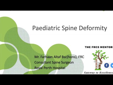 Paediatric Spine Deformities for Postgraduate Orthopaedic Exams