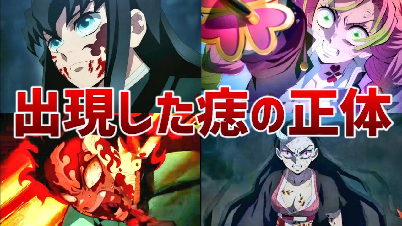 【痣って結局何？】痣者の切ない事実が判明…出現した痣の正体を徹底解説