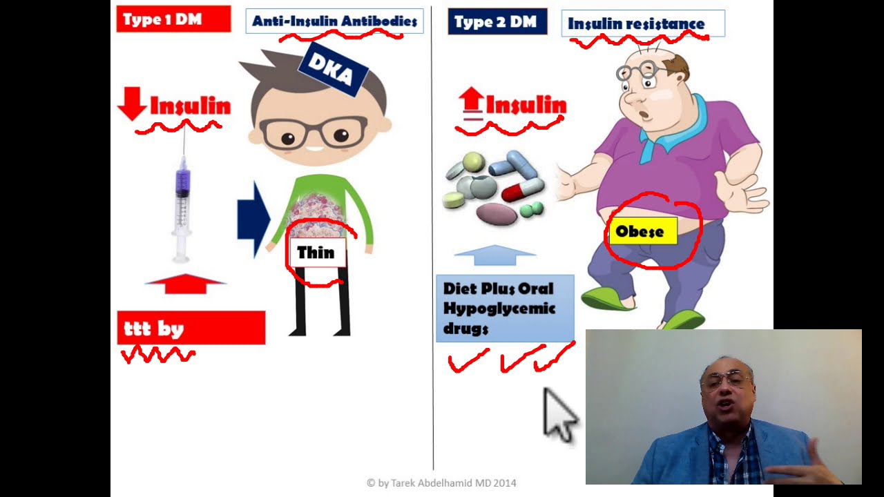Diabetes Mellitus (1) Quick Review