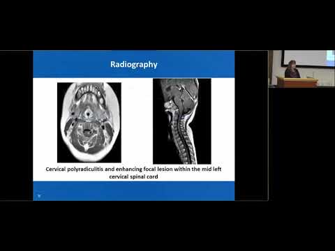 Ebola and Emerging Infectious Diseases Update 2019