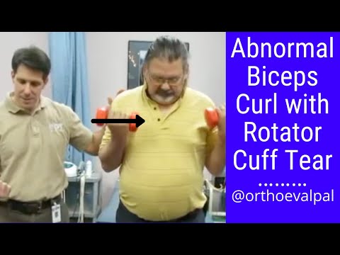 Shoulder Apprehension Test and Relocation Test