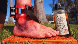 Using Red Light, Chinese Herbs, & Nails to Heal a Sprain