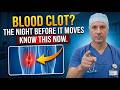 What A Blood Clot Looks Like The Night Before It Moves Know This Before It S Too Late