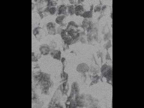 Madteo feat. Sensational - Basiado Beatdown.