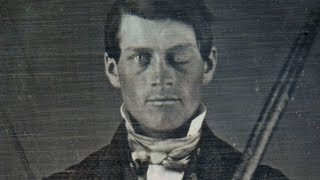 Why Scientists Are Still Fascinated By Phineas Gage