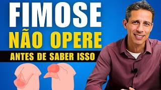 Seu filho tem FIMOSE? Veja isso ANTES de pensar em operar! (Pode Evitar)!