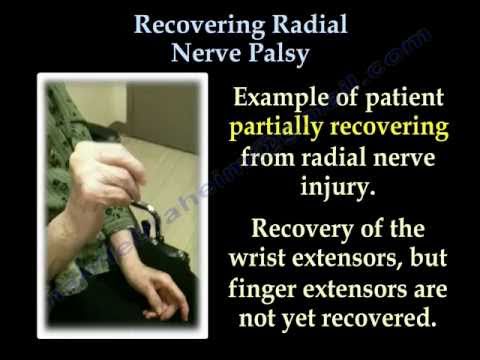 Radial Nerve Palsy ,Recovering . Part II- Everything You Need To Know - Dr. Nabil Ebraheim
