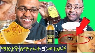 [ ማዲያት ማጥፊያ ] 5 ተፈጥሯዊ የማዲያት ማጥፊያ ዘዴዎች! 5 best ways to get rid off Melasma( Madiat)