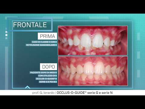 Casi clinici Intercettiva