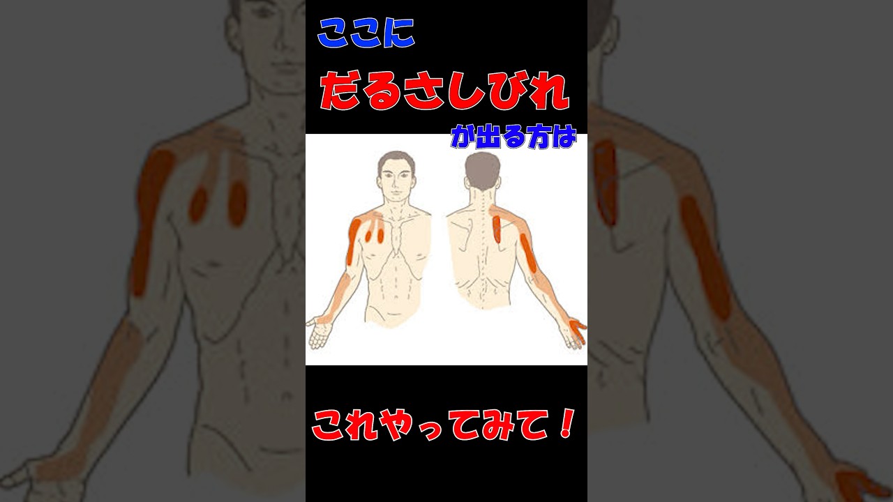 【腕 痺れ 治し方】腕がダルい痺れるときはこれ！