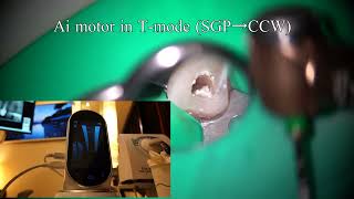 Cas clinique Ai Motor du Dr Yoshi Terauchi