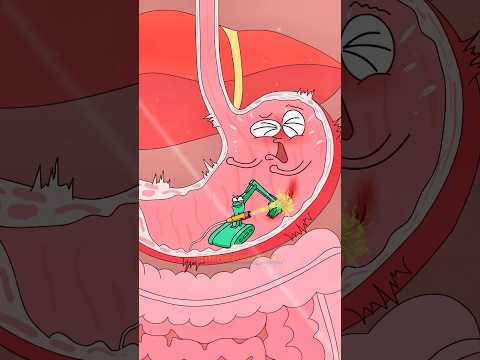 🤔H. pylori neden mide ağrısına neden olur❓#shorts