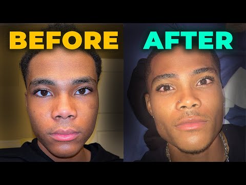 The ULTIMATE Guide To Getting An Angular Face (Every Method)