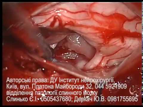 Тренировки после растяжения связок коленного сустава Деформирующий артроз мелких суставов кистей рук лечение