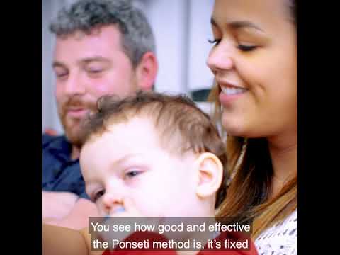 An introduction to clubfoot / talipes