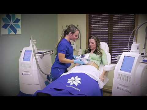 Cavallaro CoolSculpting Commercial