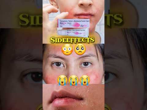 Skinlite cream || Skinlite cream ke sideeffects || skinlite के नुकसान 😭😭