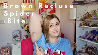 Brown Recluse Spider Bite | I was POISONED!