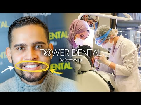 A Perfect Smile Makeover in Istanbul Turkey – Cost, Clinics, and Care