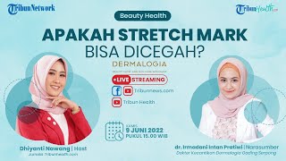 BEAUTY HEALTH: Apakah Stretch Mark Bisa Dicegah?