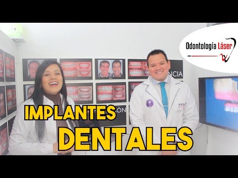 Implantes dentales – Odontología Láser