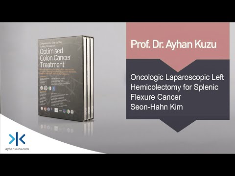 3.2.2. Oncologic Laparoscopic Left Hemicolectomy for Splenic Flexure Cancer - Seon-Hahn Kim