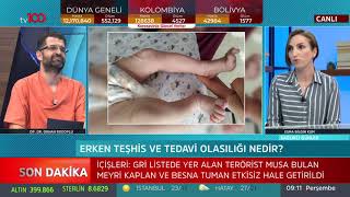 Bebeklerde fizyoterapi - Esma Bilgin Kum - Sağlıklı Günler - 9 Temmuz 