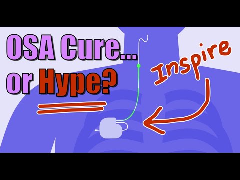 Inspire Sleep: Obstructive Apnea Cure or Misleading Hype? No CPAP No Mask?