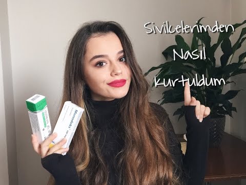 download lagu mp3 mp4 Belogent, download lagu Belogent gratis, unduh video klip Belogent