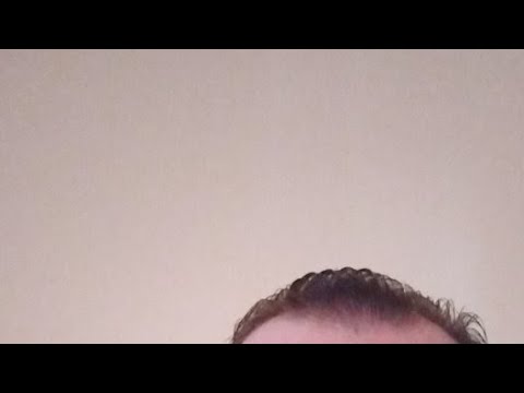 I Have A Strange Day Today Thingsup Anddown Hopeokay 😡Now🤗