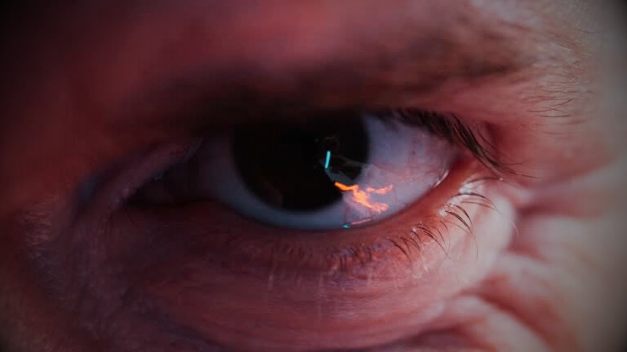 Como é viver com uma pessoa psicótica | HISTÓRIA DO REDDIT