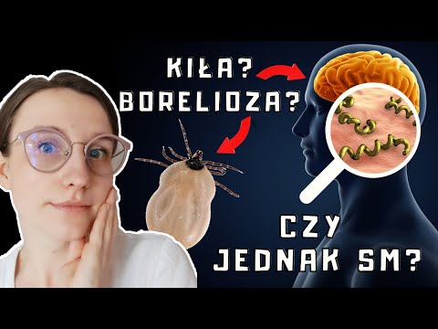 Czy to STWARDNIENIE ROZSIANE? Co daje podobne OBJAWY? Borelioza, kiła? Czy mam SM?  | O, choroba!